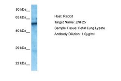 ZNF25 Rabbit anti-Human, Polyclonal, Novus Biologicals 0.1 mL | Buy Online | Novus Biologicals | Fisher Scientific
